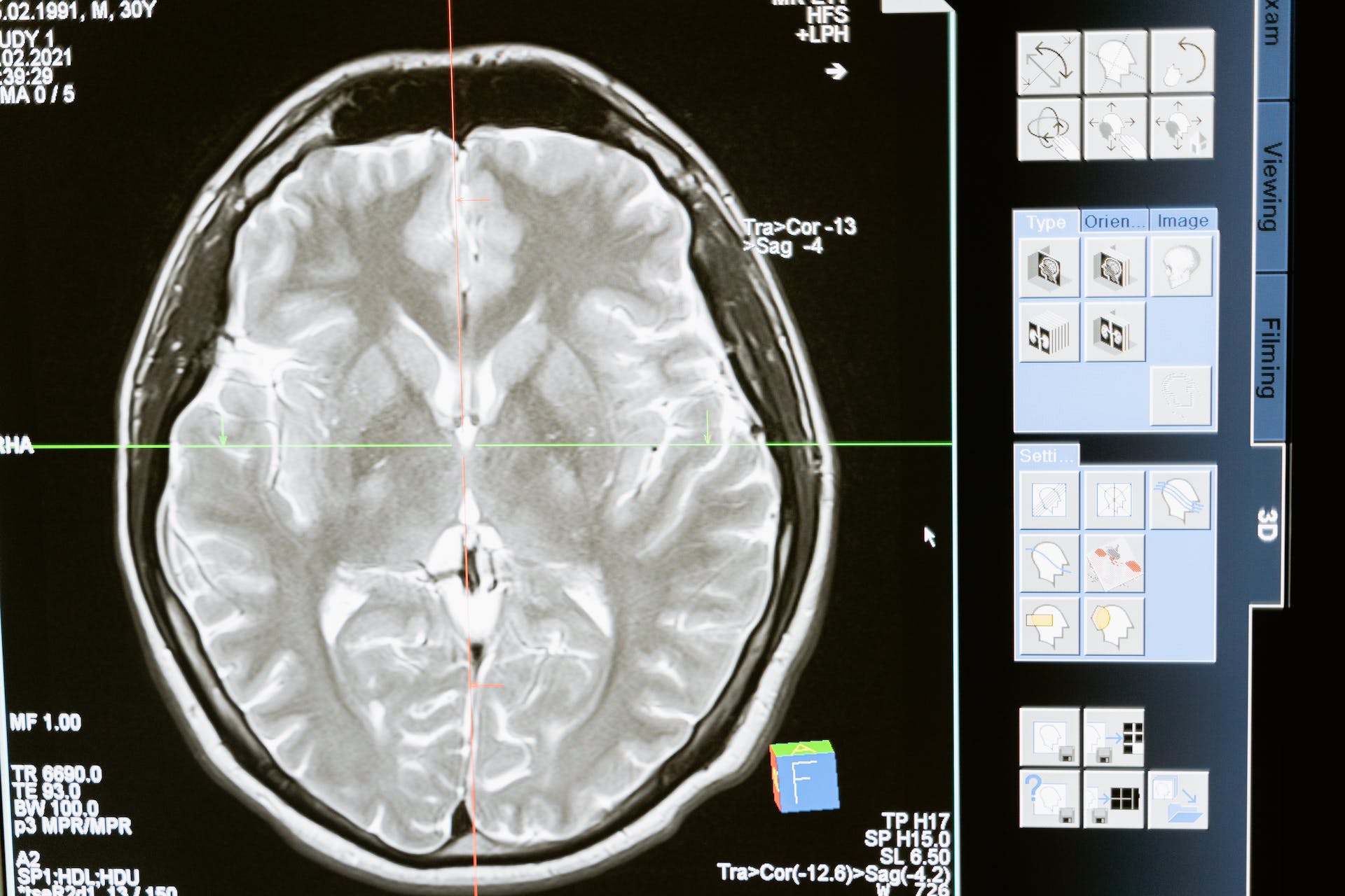 A brain scan from an MRI machine